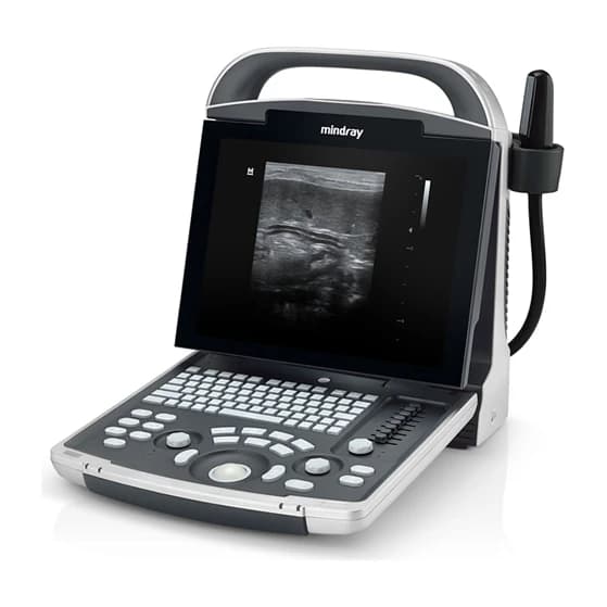 DP-30 Vet portable veterinary ultrasound system