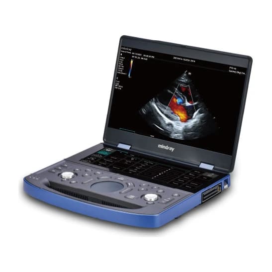 Vetus E7 hand-carried laptop veterinary ultrasound system