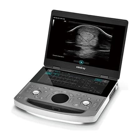 Vetus EQ portable laptop equine ultrasound system