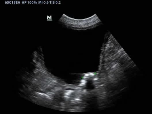 DP-50 Vet clinical ultrasound image: Canine Bladder
