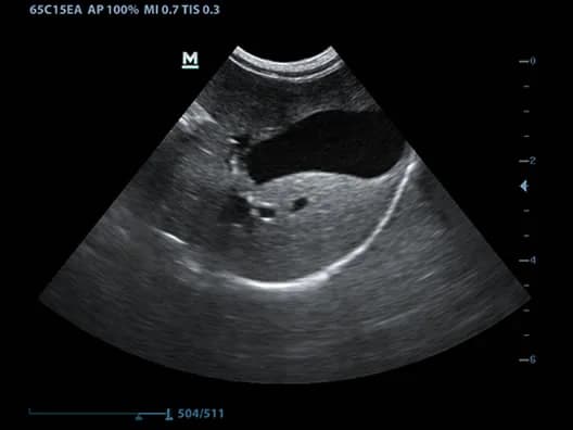 DP-50 Vet clinical ultrasound image: Canine Gallbladder