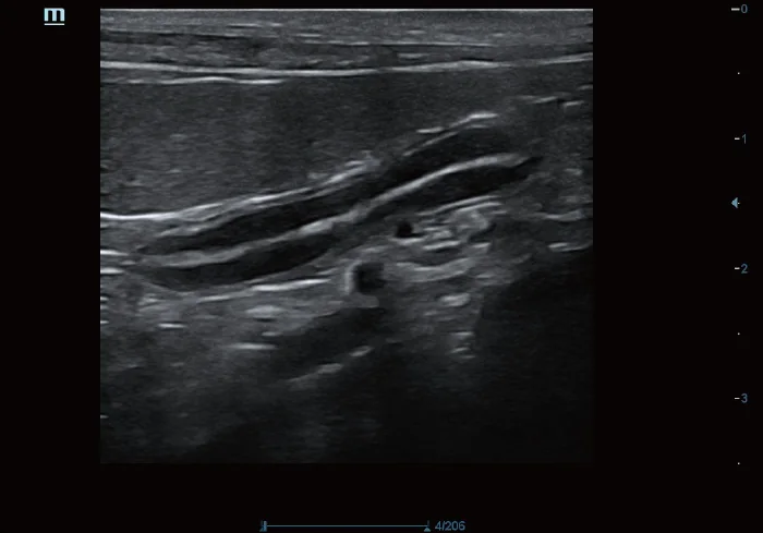 Vetus 5 clinical ultrasound image: Feline Abdomen