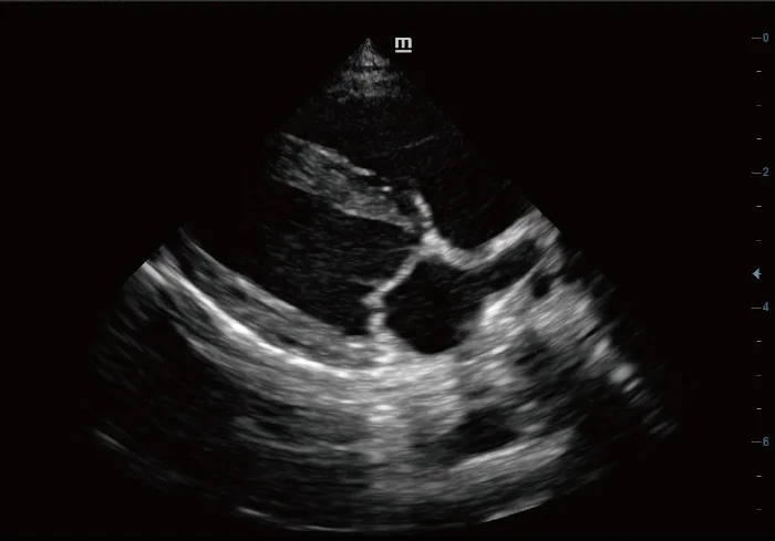 Vetus 5 clinical ultrasound image: Long Axis View of Canine Heart