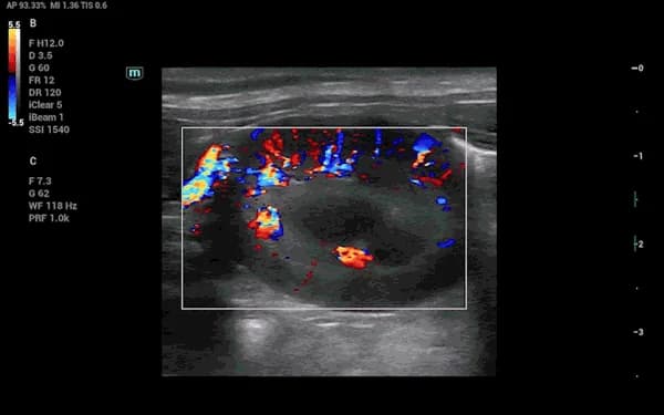Vetus 50 clinical ultrasound image: Canine Kidney Vessel