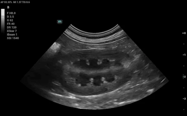 Vetus 50 clinical ultrasound image: Canine Kidney