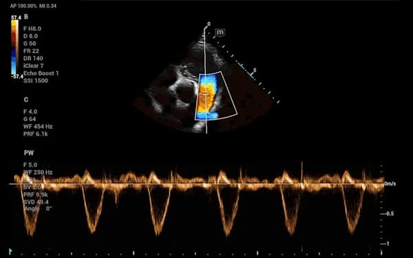 Vetus 50 clinical ultrasound image: Feline Pulmonary Artery (PW)
