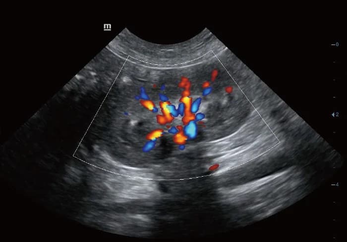 Vetus 5Exp clinical ultrasound image: Color Mode of Canine Kidney