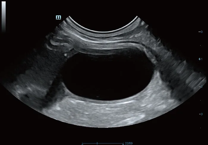 Vetus 5Exp clinical ultrasound image: Feline Bladder