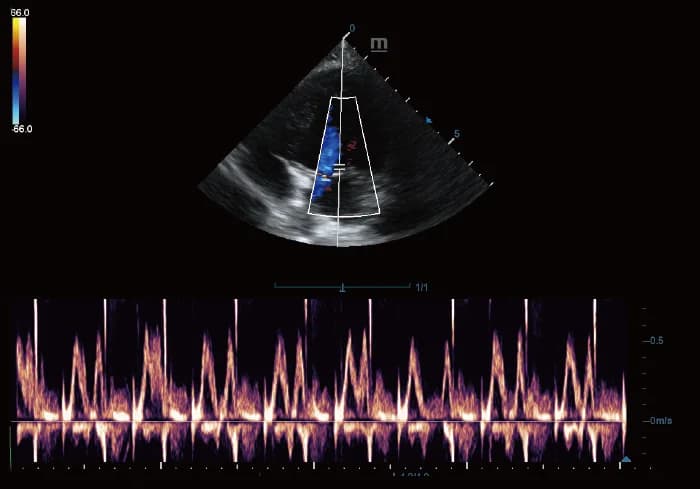 Vetus 5Exp clinical ultrasound image: PW Mode of Canine Heart