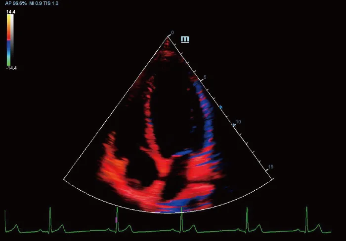 Vetus 5Exp clinical ultrasound image: TDI of Canine Heart