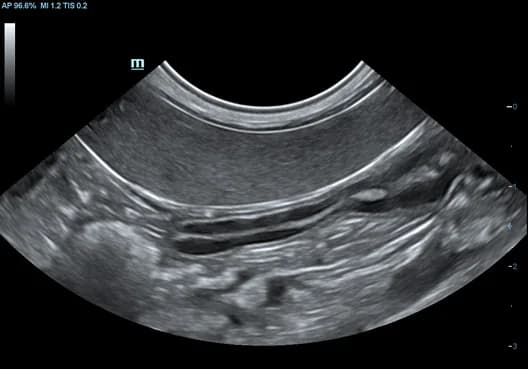 Vetus 7 clinical ultrasound image: Canine Abdomen