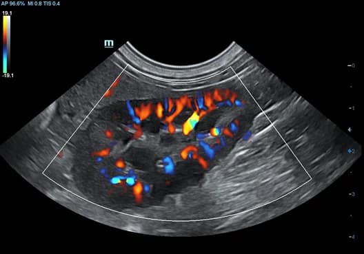 Vetus 7 clinical ultrasound image: Canine Kidney