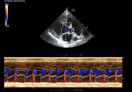 Vetus 7 clinical ultrasound image: Color M mode of Canine Heart