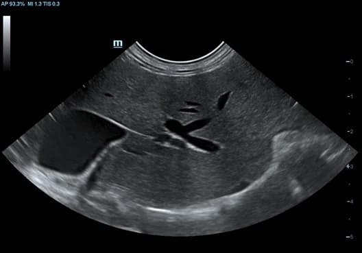 Vetus 7 clinical ultrasound image: Feline Liver
