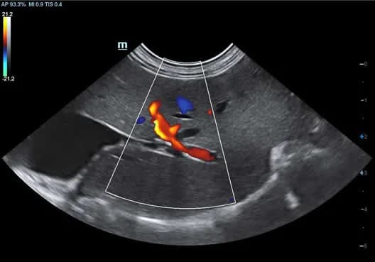 Vetus 7 clinical ultrasound image: Hepatic Flow Feline