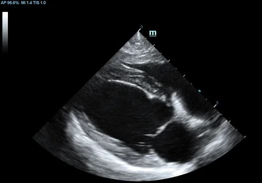 Vetus 7 clinical ultrasound image: Long Axis View of Canine Heart