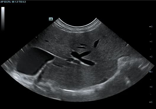 Vetus 8 clinical ultrasound image: Feline Liver