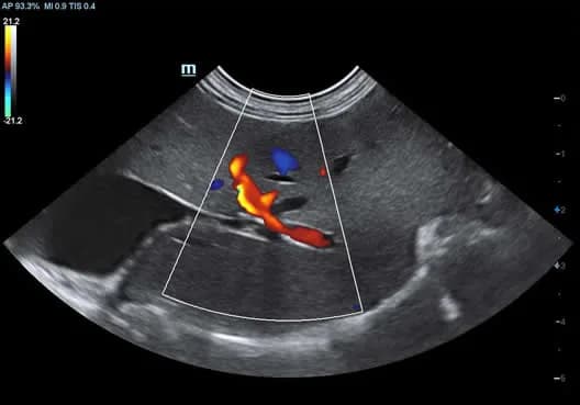 Vetus 8 clinical ultrasound image: Hepatic Flow Feline