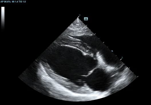 Vetus 8 clinical ultrasound image: Long Axis View of Canine Heart