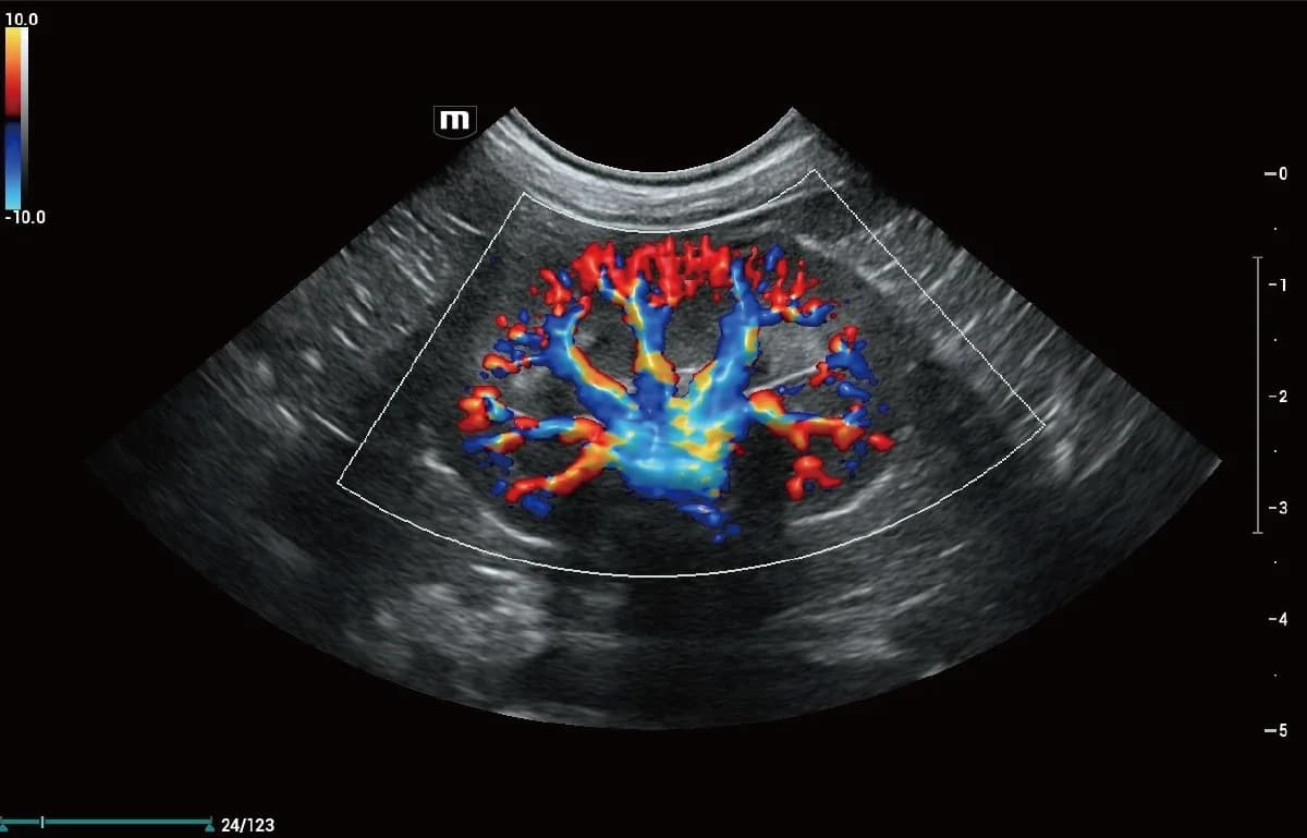 Vetus 9 clinical ultrasound image: Canine Kidney Glazing Flow
