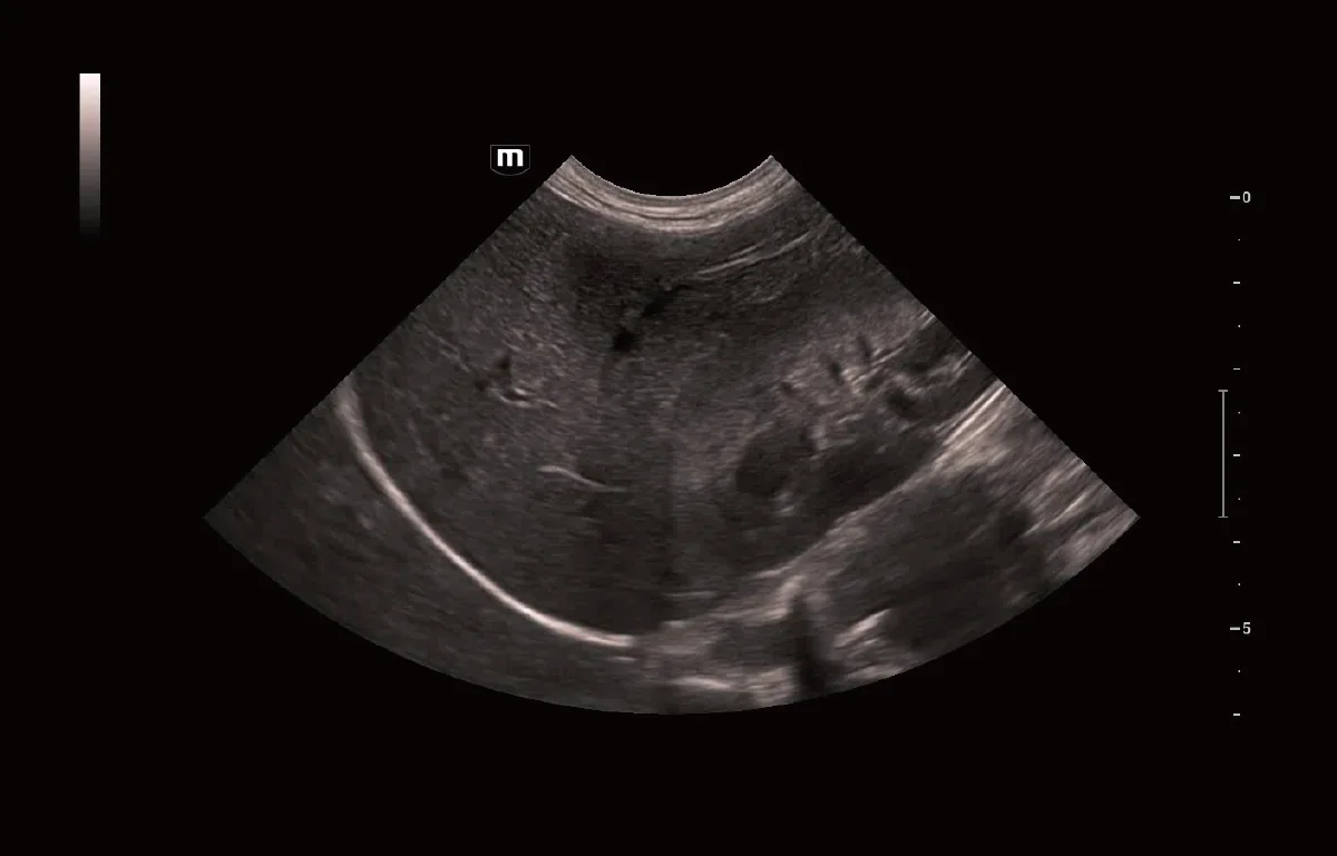 Vetus 9 clinical ultrasound image: Canine Liver and Kidney Plane