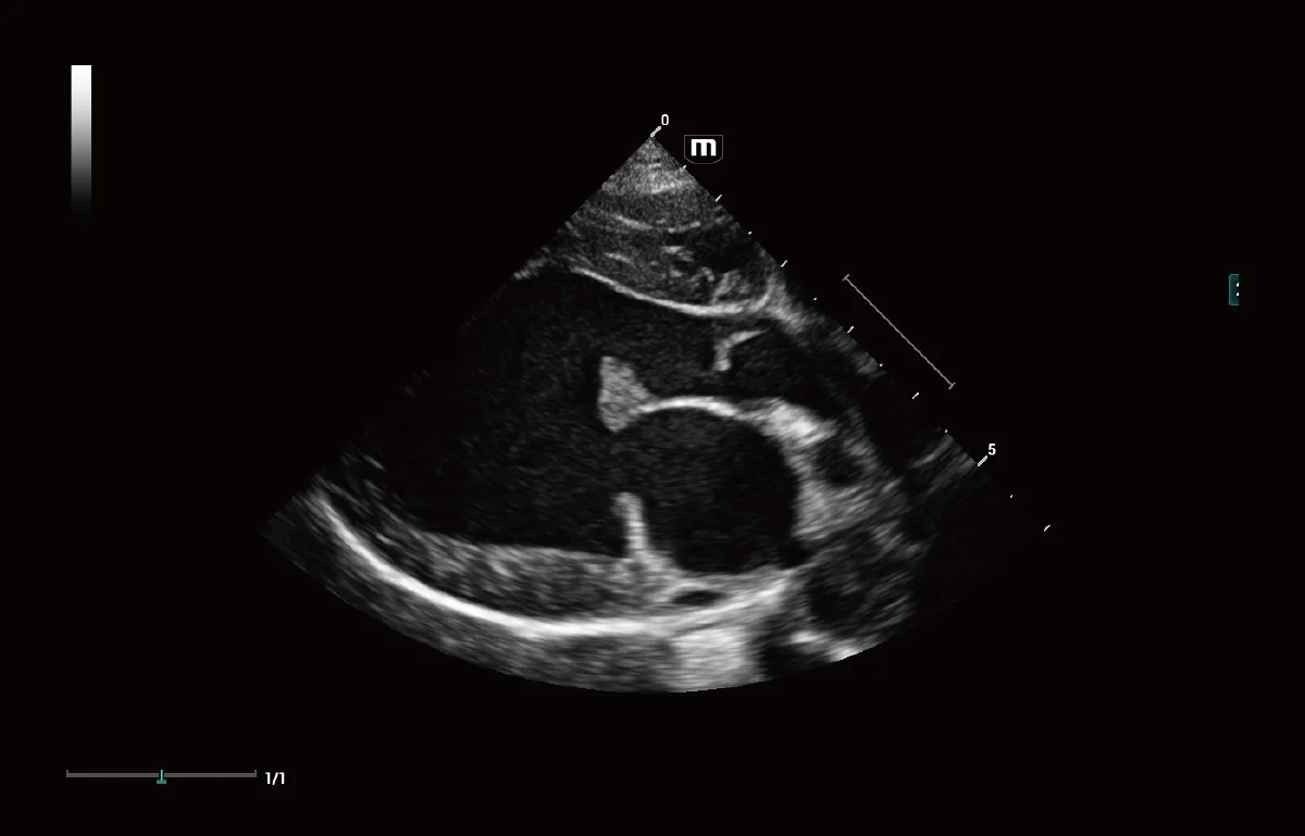 Vetus 9 clinical ultrasound image: Canine Myxomatous Mitral Valve Disease (MMVD)