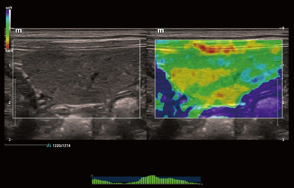 Vetus 9 clinical ultrasound image: Canine Spleen Natural Touch Elastography