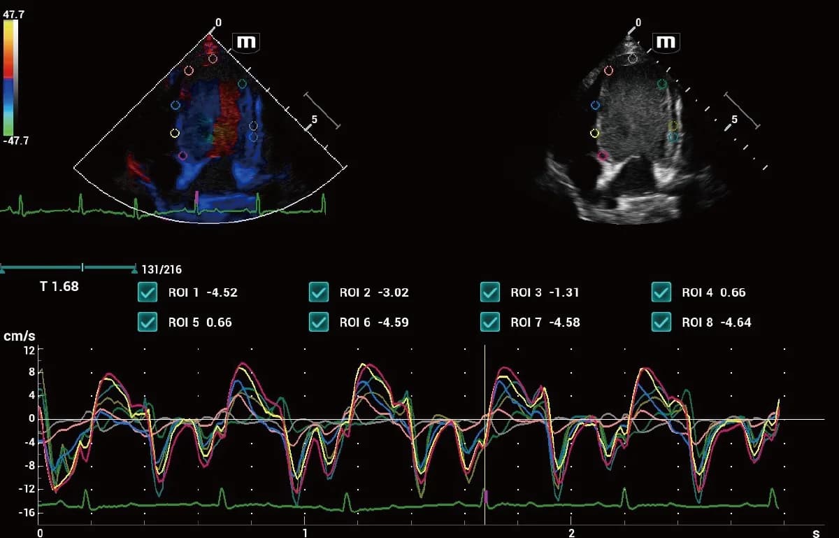 Vetus 9 clinical ultrasound image: Canine TDI QA