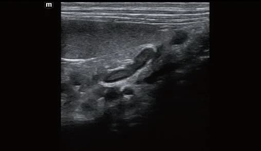 Vetus E7 clinical ultrasound image: Adrenal gland of canine