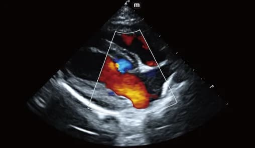 Vetus E7 clinical ultrasound image: Cardiac blood flow of canine