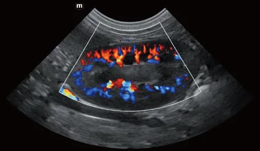 Vetus E7 clinical ultrasound image: Renal blood flow of canine