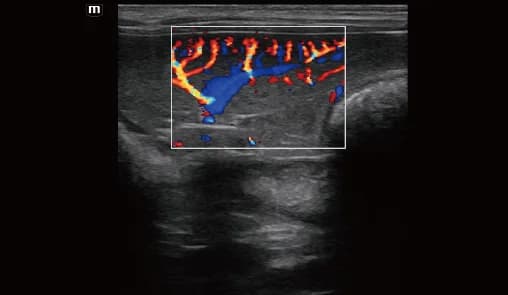 Vetus E7 clinical ultrasound image: Spleen blood flow of canine