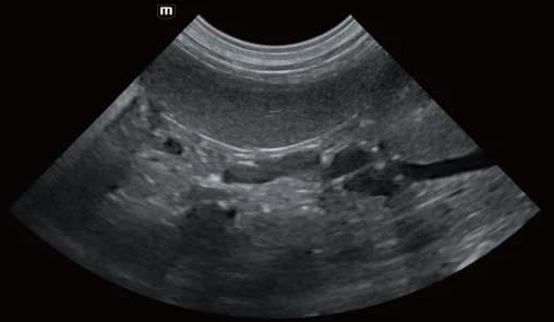 Vetus E7 clinical ultrasound image: Spleen of canine