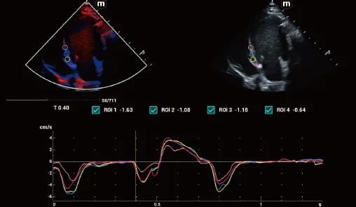 Vetus E7 clinical ultrasound image: TDI QA of canine