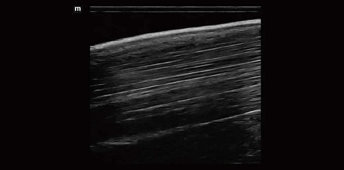 Vetus EQ clinical ultrasound image: Equine Proximal Metacarpal Region