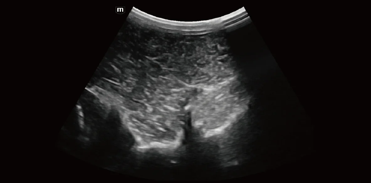 Vetus EQ clinical ultrasound image: Equine Spine