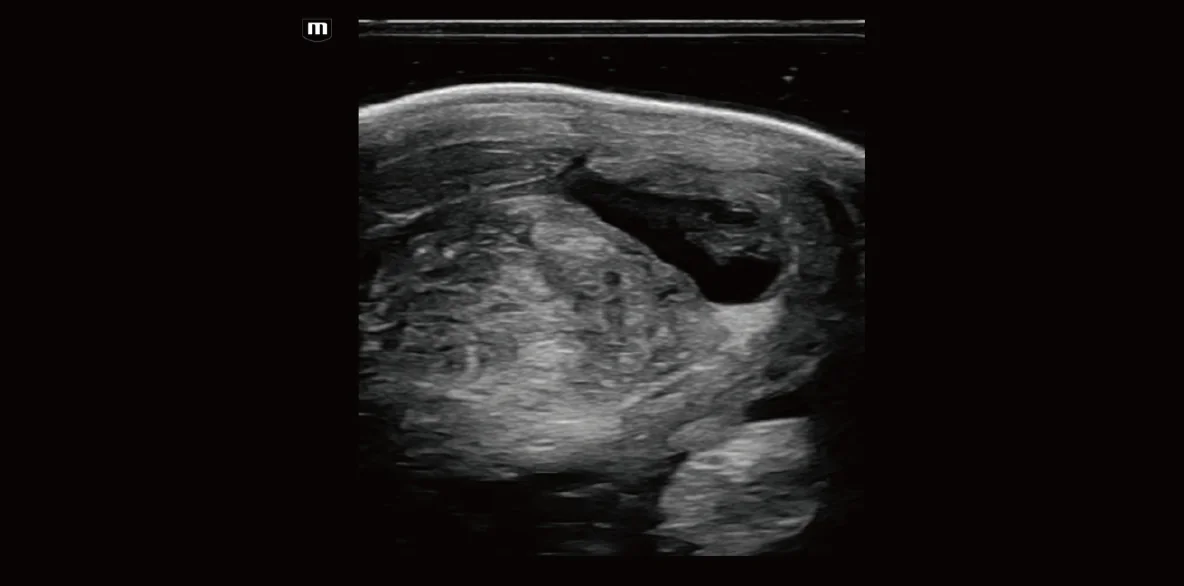 Vetus EQ clinical ultrasound image: Equine Tendon Hydrops