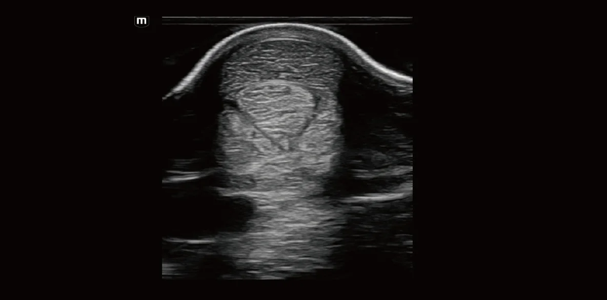 Vetus EQ clinical ultrasound image: Equine Tendon