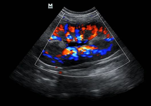 Z60 Vet clinical ultrasound image: Canine Kidney