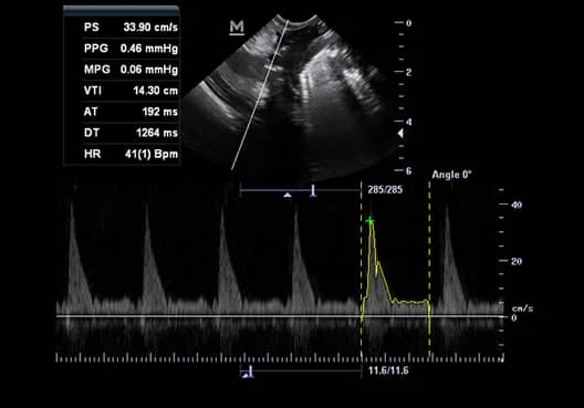Z60 Vet clinical ultrasound image: Turtle Cardiac PW